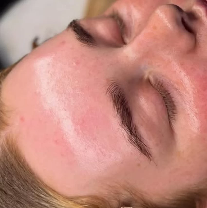 What is a Facial Treatment