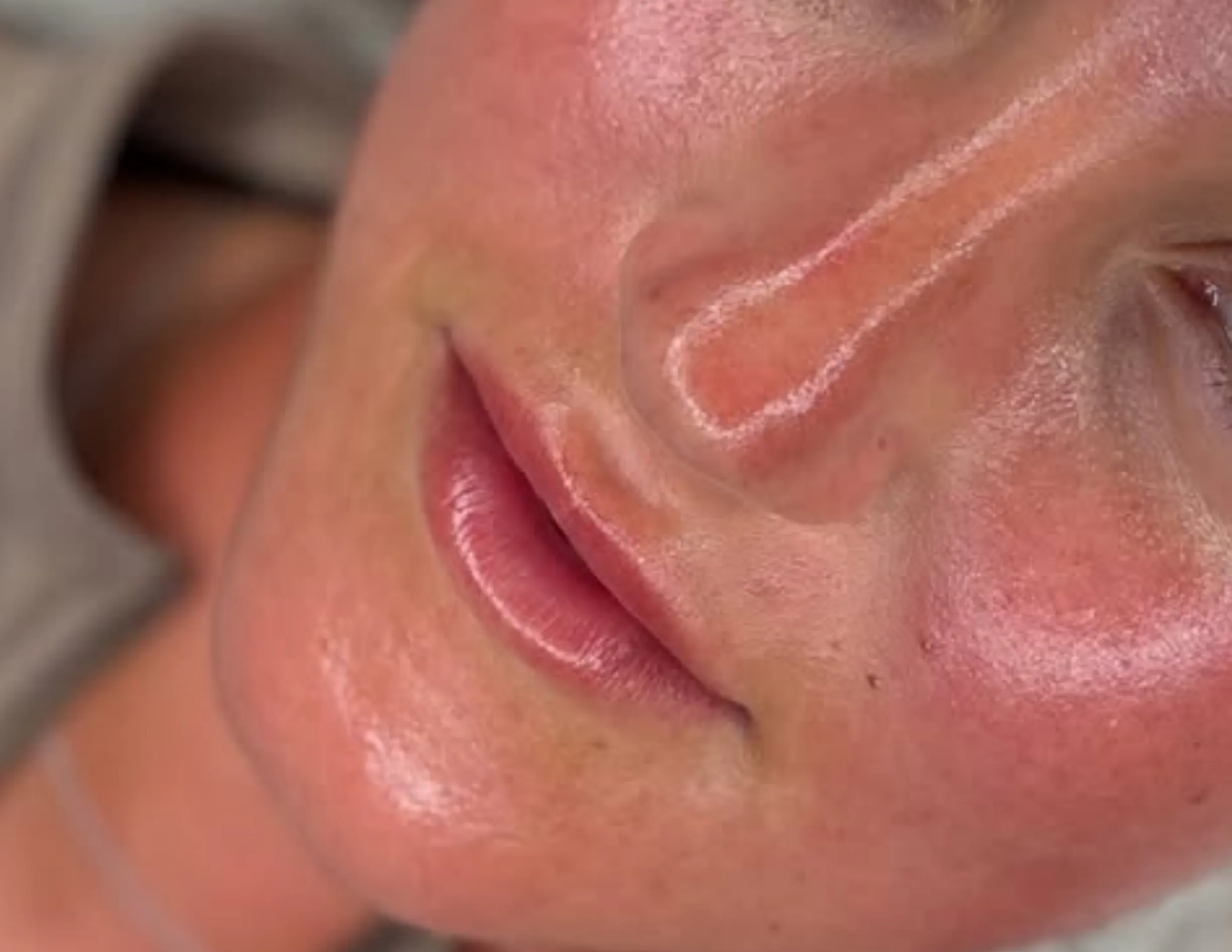 benefits of professional facials