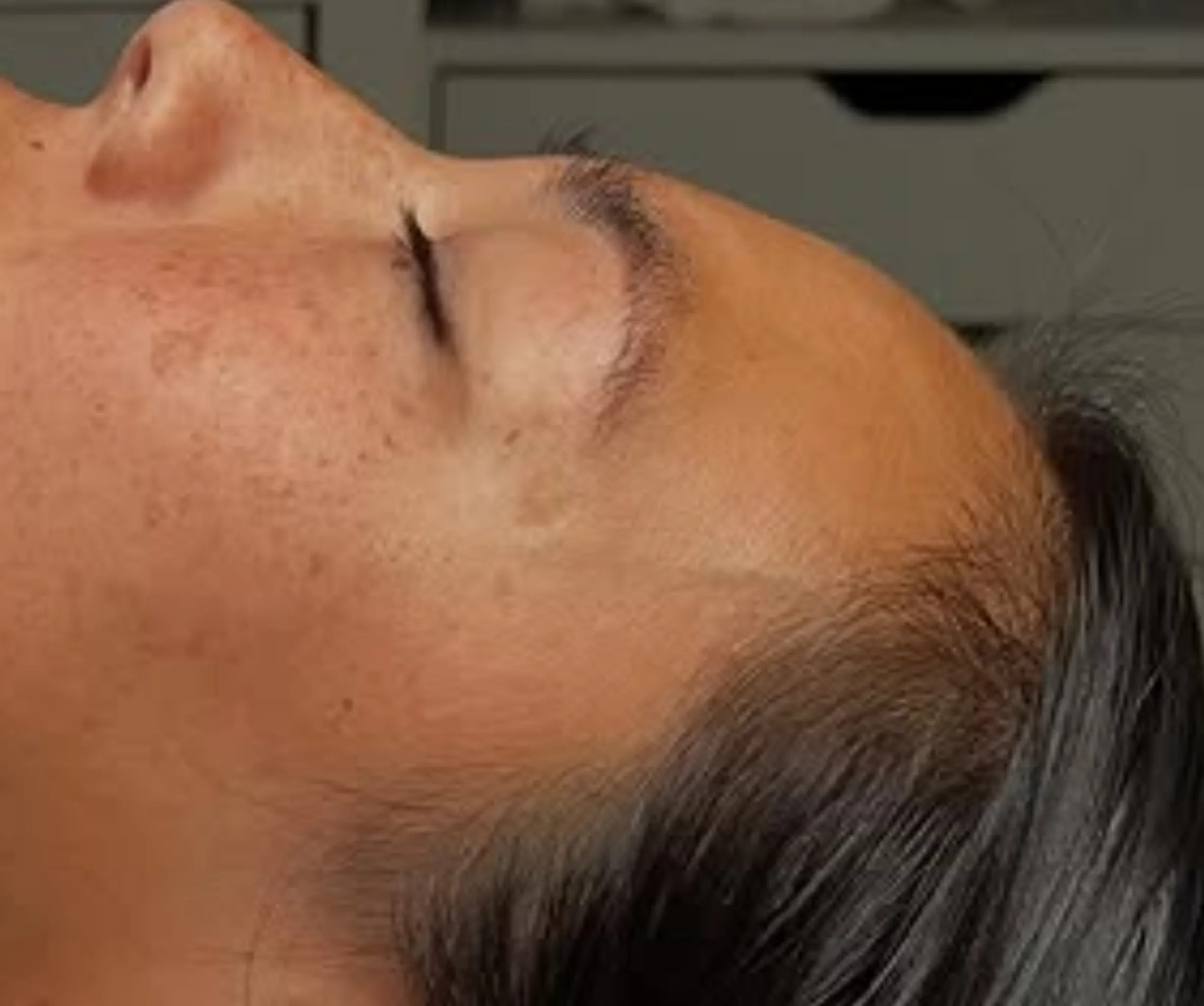 how facials help skin