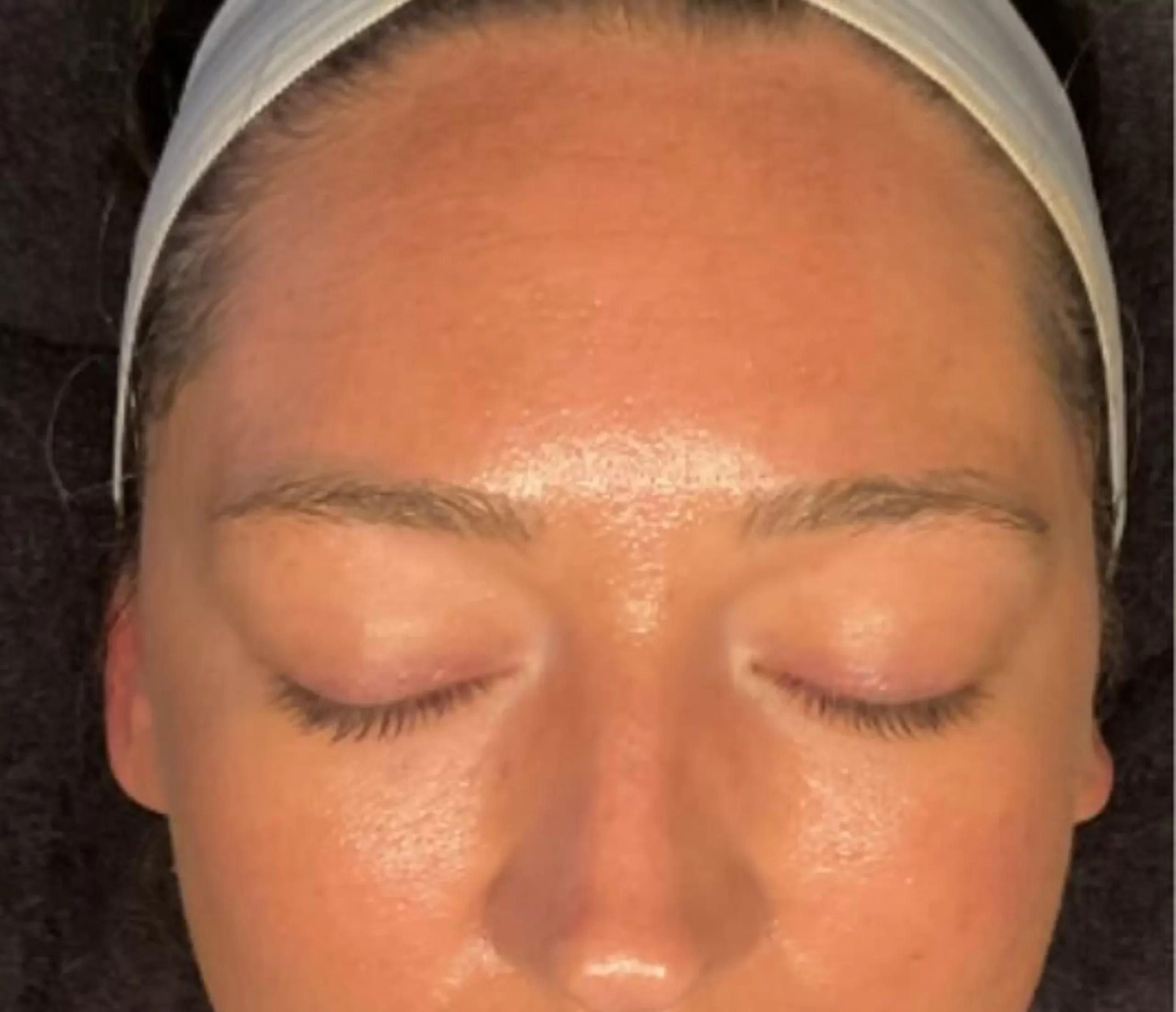 skin therapist Brisbane