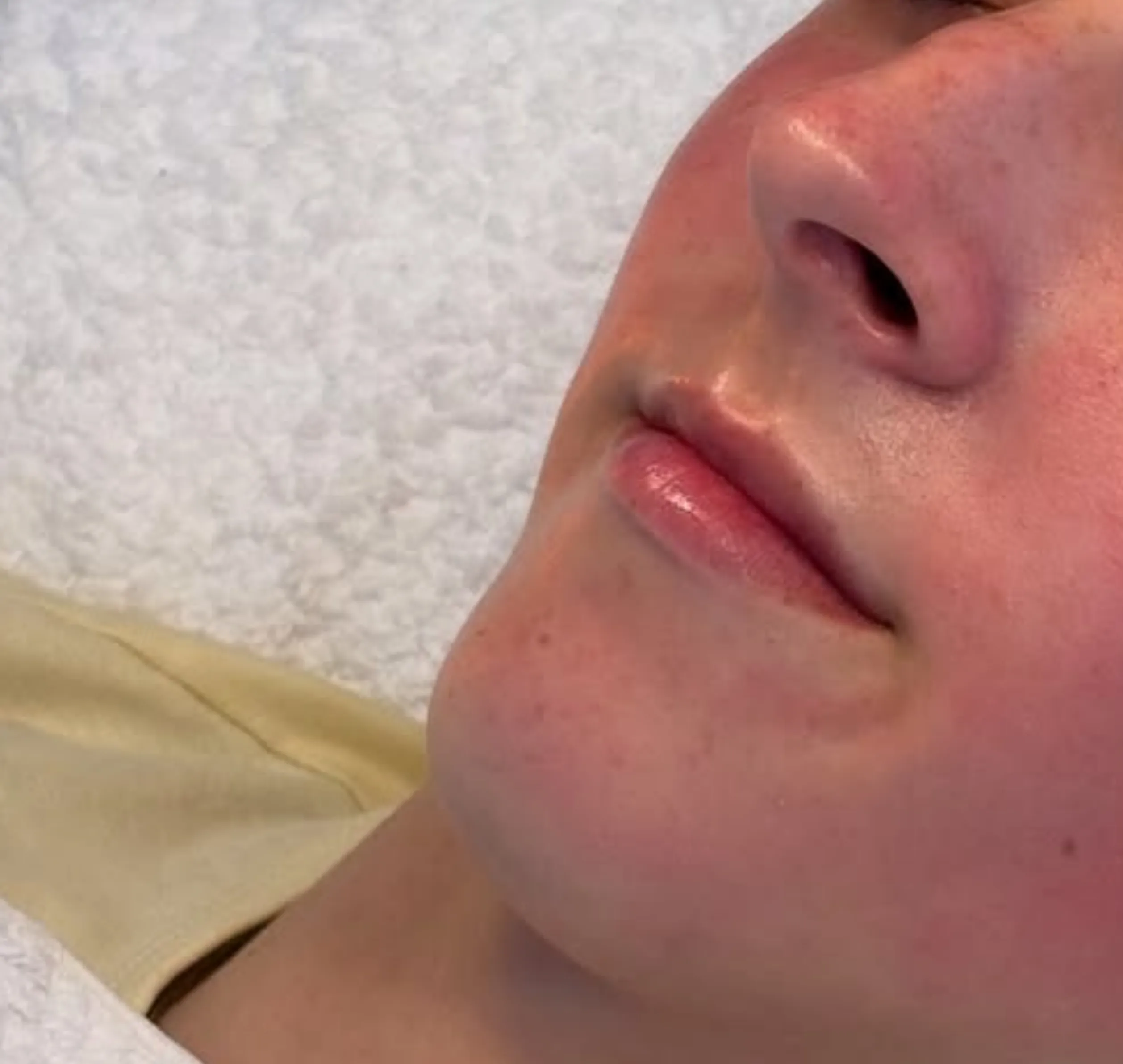 steps in a facial treatment