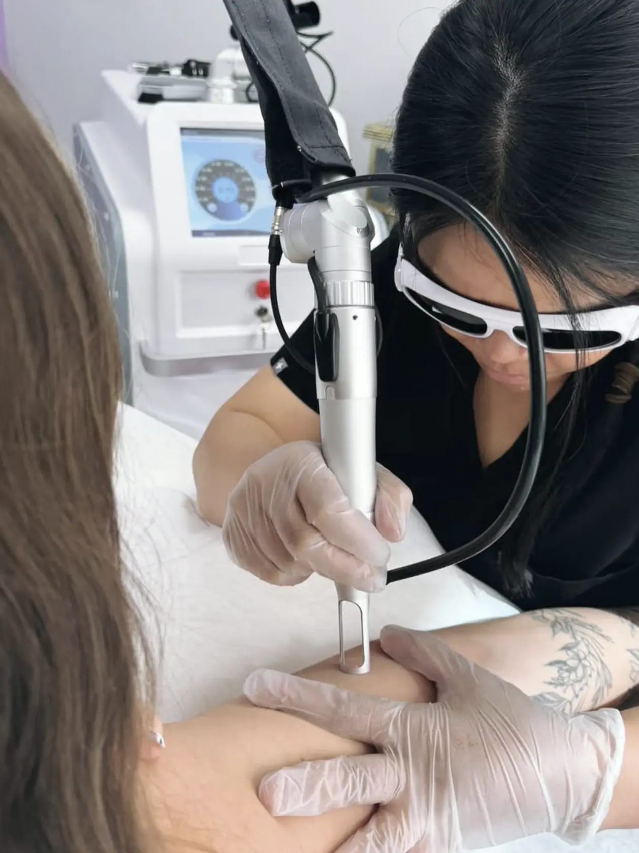 laser tattoo removal qualifications australia