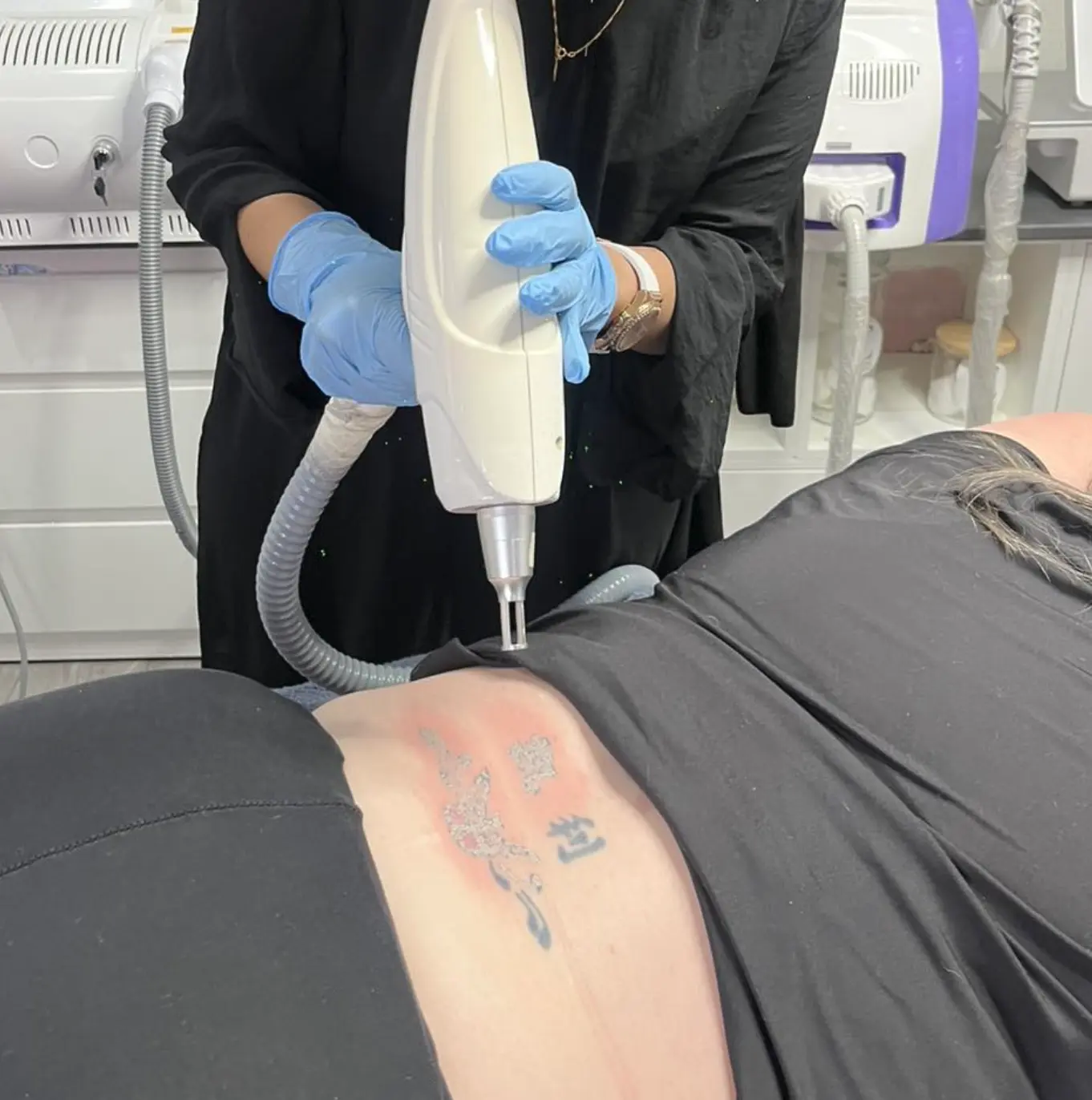 tattoo removal school near me